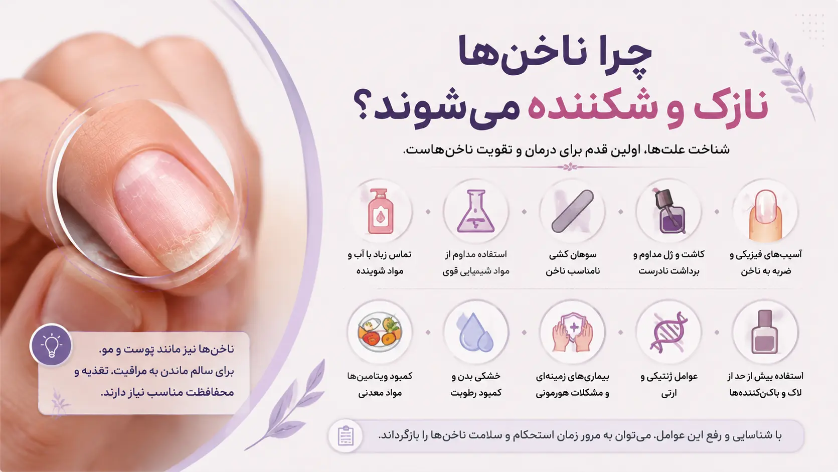 چرا ناخنها نازک و شکننده میشوند؟ - درمان نازکی و شکنندگی ناخن