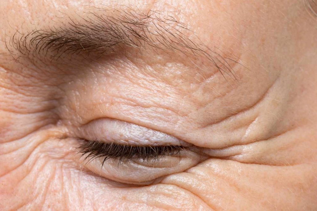7 عادت روزانه که باعث تشدید چین و چروک دور چشم می‌شوند