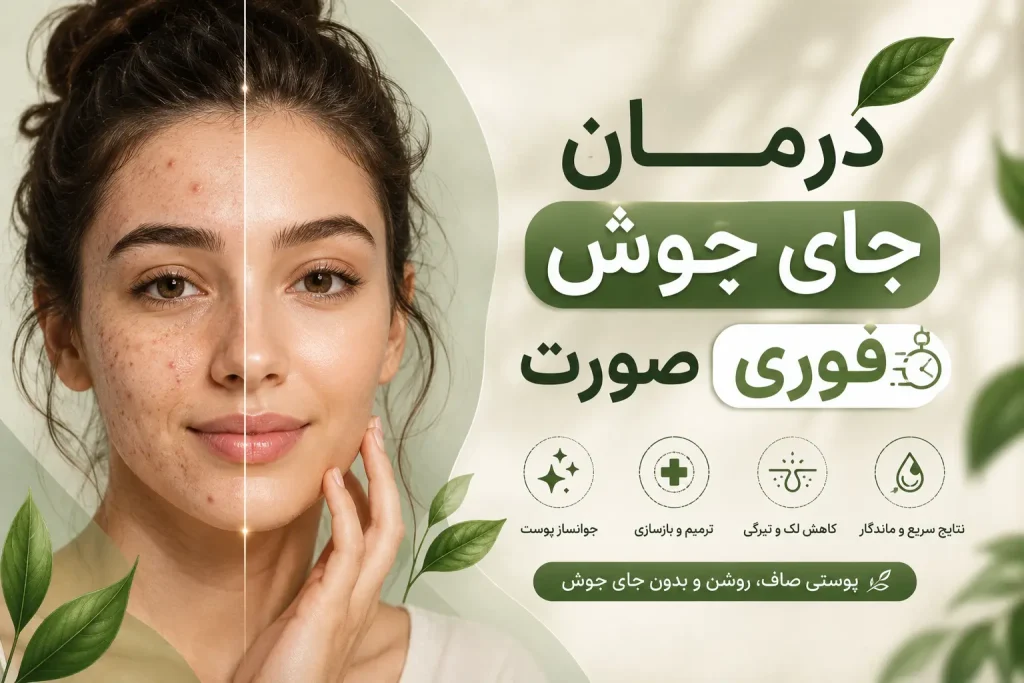 درمان جای جوش صورت فوری